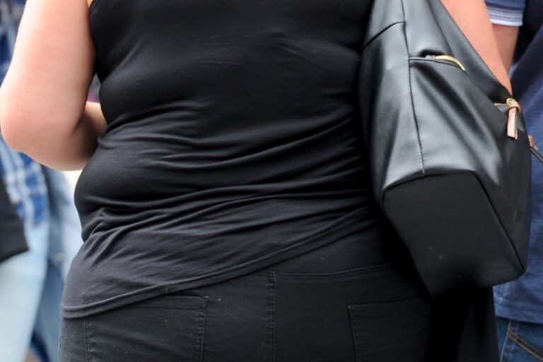 Young obese women driving rise in type 2 diabetes, study suggests Young obese women driving rise in type 2 diabetes, study suggests