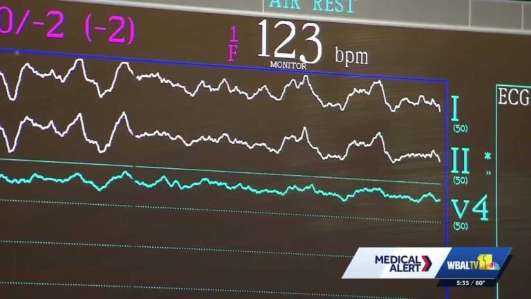 Aortic Hope urges people to watch for signs of aortic dissection Aortic Hope urges people to watch for signs of aortic dissection