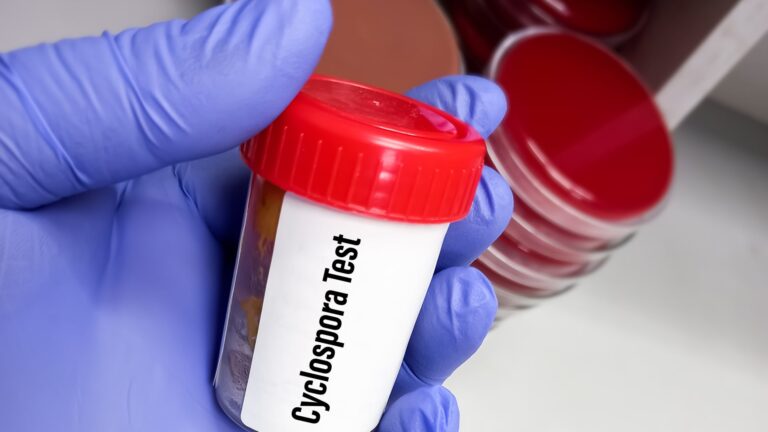 Outbreak of diarrhea-causing parasite grows to more than 1,000 cases