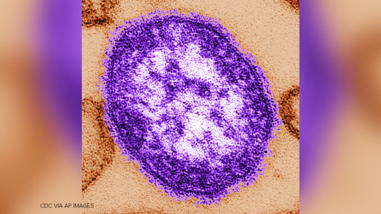 US measles cases reach 35-year high, for second record