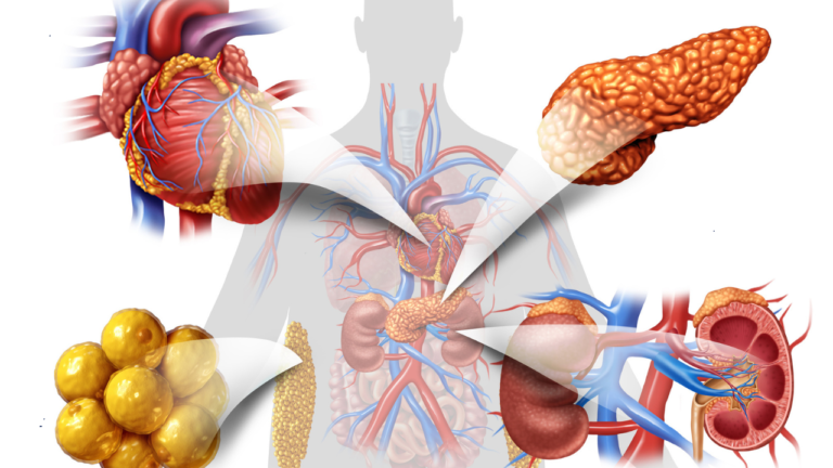 Obesity-Driven CKM Syndrome A Growing Public Health Threat, Warns American Heart Association Obesity-Driven CKM Syndrome A Growing Public Health Threat, Warns American Heart Association
