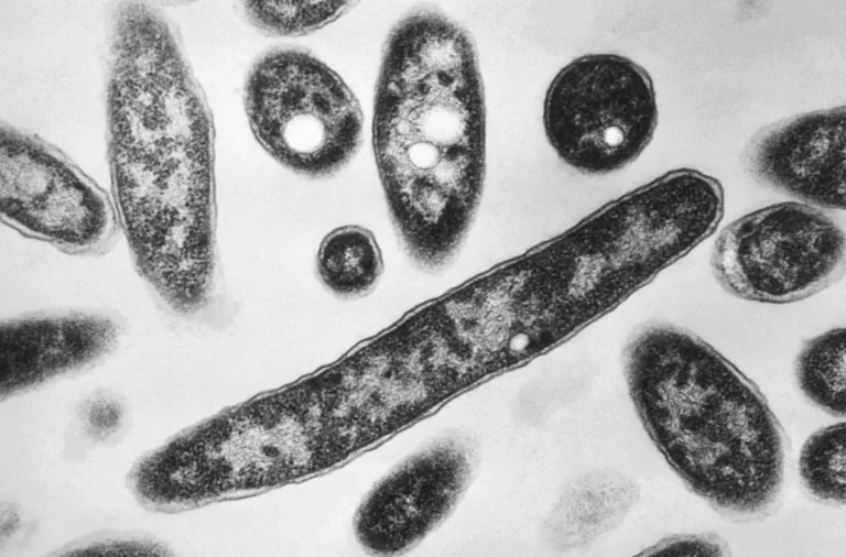 In New York, the number of victims of the Legionnaires’ disease outbreak has increased In New York, the number of victims of the Legionnaires' disease outbreak has increased
