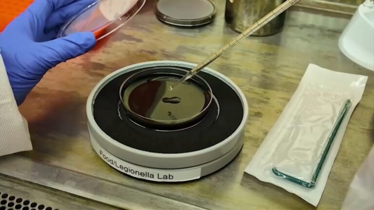 What to know about NYC Legionnaires’ disease outbreak, symptoms and prevention What to know about NYC Legionnaires' disease outbreak, symptoms and prevention