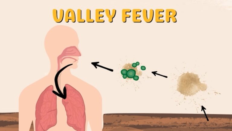 Inspire Health launches Valley Fever Care Program to expand treatment Inspire Health launches Valley Fever Care Program to expand treatment