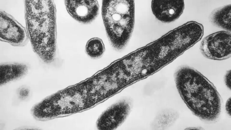 New York City health department says UES Legionnaires' cluster exposure has ended