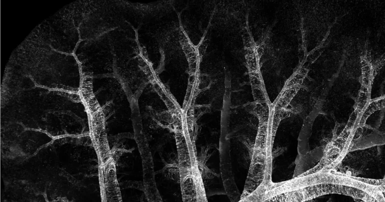 MSU research provides new insights into rare pediatric lung disease MSU research provides new insights into rare pediatric lung disease