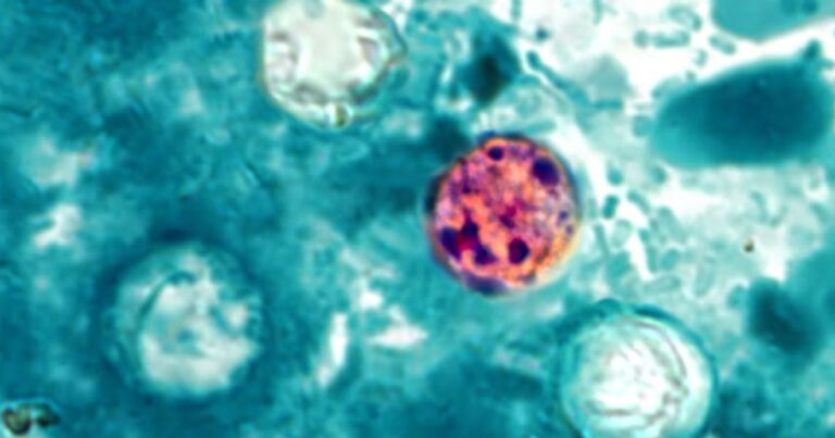 Lettuce or salad greens could be source of diarrhea-causing illness, Michigan health officials say Lettuce or salad greens could be source of diarrhea-causing illness, Michigan health officials say