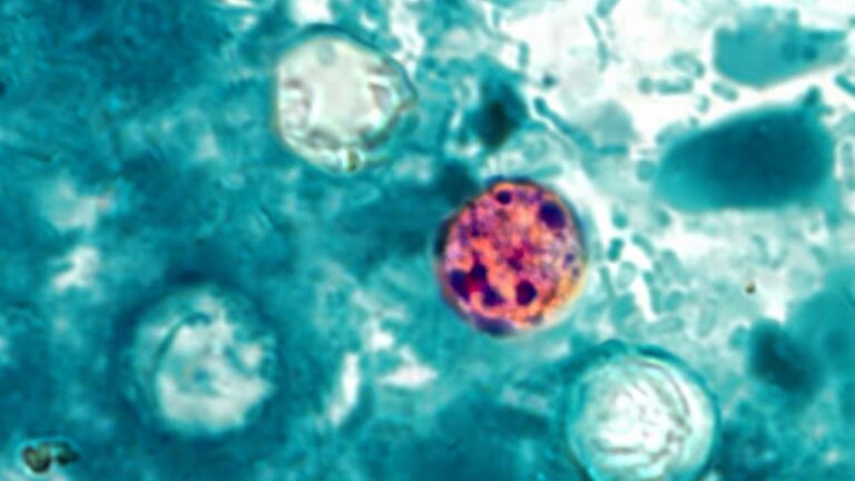 Maryland reports more cases of the parasitic infection cyclosporiasis Maryland reports more cases of the parasitic infection cyclosporiasis
