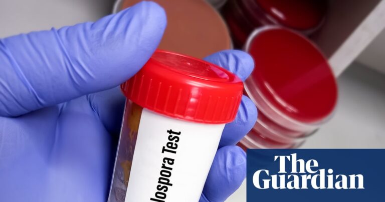 Trump’s deep public health cuts hinder response to record US cyclosporiasis outbreak Trump’s deep public health cuts hinder response to record US cyclosporiasis outbreak