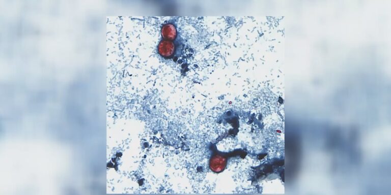 Health care providers warn of severe stomach bug illness in Illinois Health care providers warn of severe stomach bug illness in Illinois