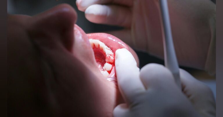 Why periodontal disease isn't just a dental problem anymore