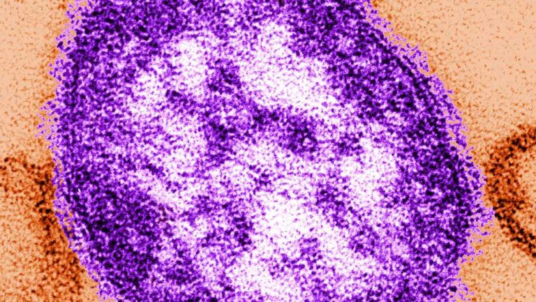 Health officials: Measles virus detected in Douglas County wastewater, but no cases confirmed