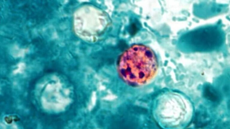 Cases of 'explosive' diarrhea parasite soaring in Michigan, Illinois; health officials issue warning