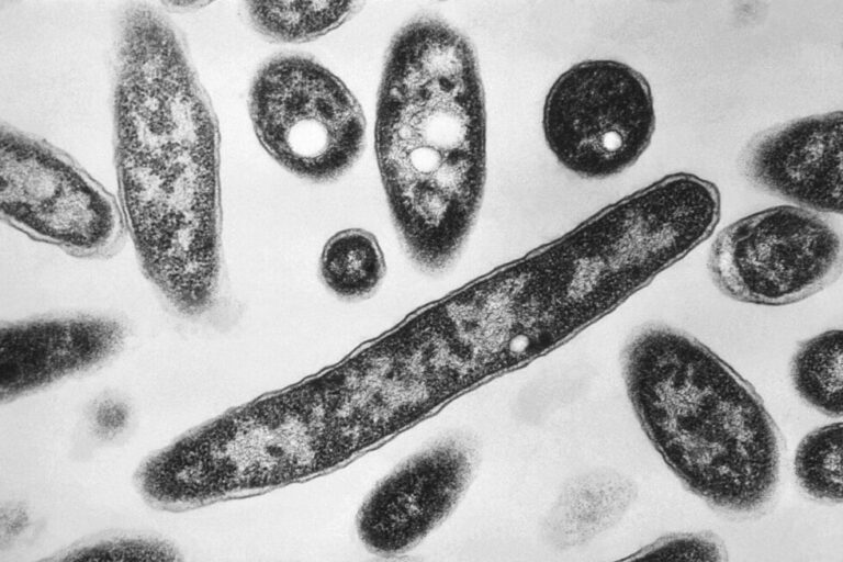 New cases slow in NYC Legionnaires’ disease outbreak; Met museum among buildings with positive tests New cases slow in NYC Legionnaires' disease outbreak; Met museum among buildings with positive tests