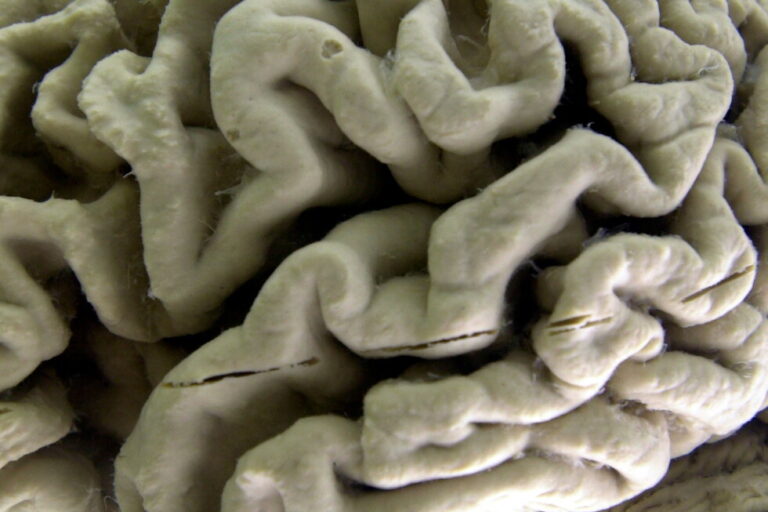 Study shows a blood test can help identify healthy people at high risk for Alzheimer's disease