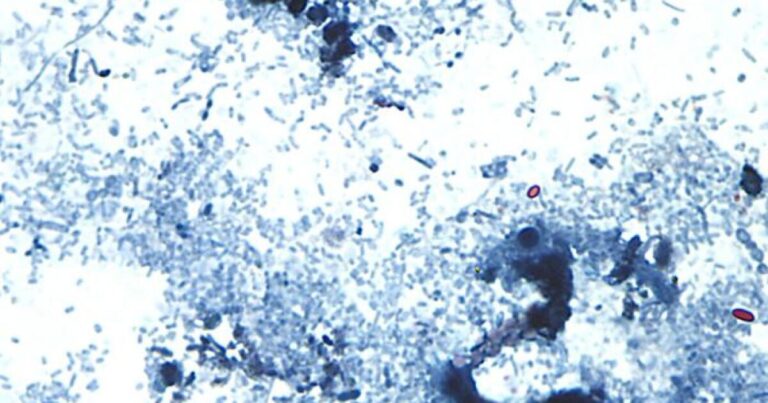 CDC sending ‘disease detectives’ to Ohio to help with cyclosporiasis investigation