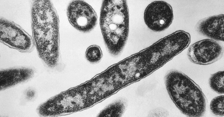 Several cases of Legionnaires’ disease confirmed in Franklin County, health department reports Several cases of Legionnaires’ disease confirmed in Franklin County, health department reports