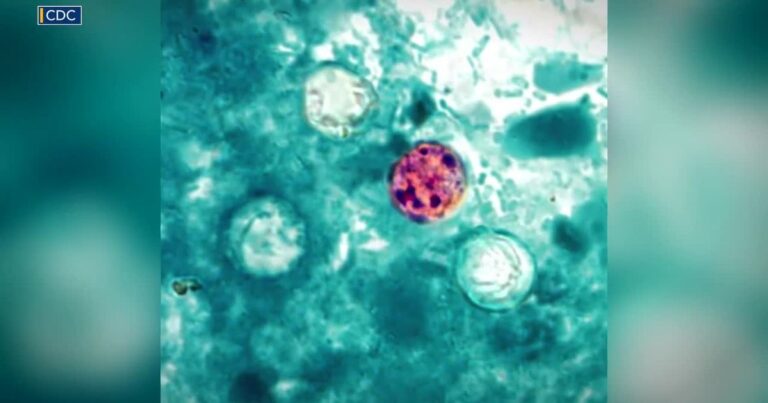 More people are seeking Cyclospora tests. Here’s what patients should know More people are seeking Cyclospora tests. Here's what patients should know