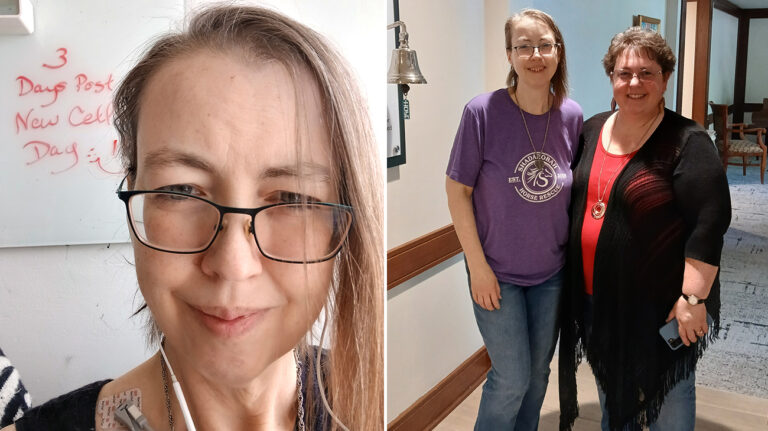 CAR T-Cell Therapy Shows Promise for Woman With Amyloidosis in Early Clinical Trial CAR T-Cell Therapy Shows Promise for Woman With Amyloidosis in Early Clinical Trial