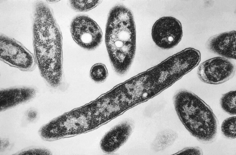 Legionnaire’s disease outbreak on Upper East Side claims its sixth victim Legionnaire’s disease outbreak on Upper East Side claims its sixth victim