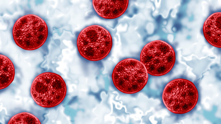 Alabama Department of Public Health reports 28 cases of cyclosporiasis
