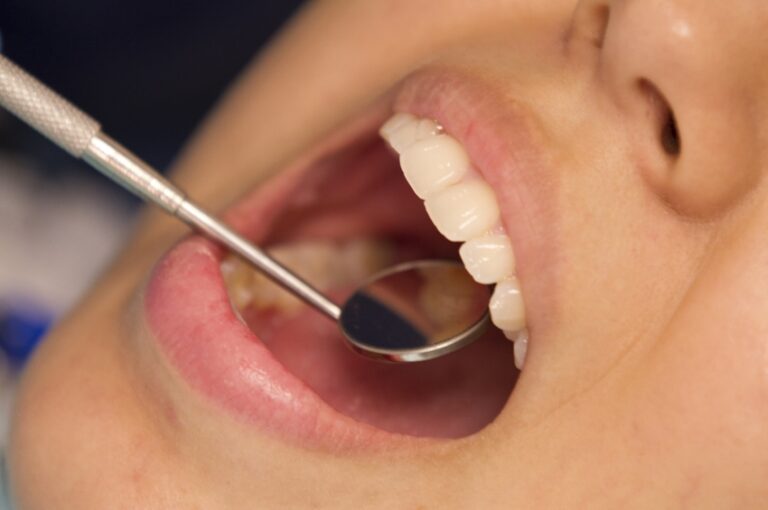 Bacteria from gum disease may cause inflammation, harden heart valves Bacteria from gum disease may cause inflammation, harden heart valves