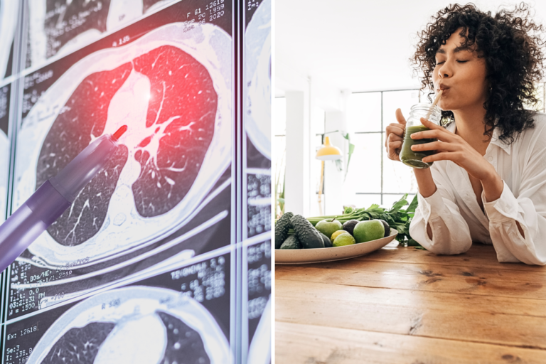Non-smokers under 50 are getting lung cancer. What they eat raised a red flag Non-smokers under 50 are getting lung cancer. What they eat raised a red flag