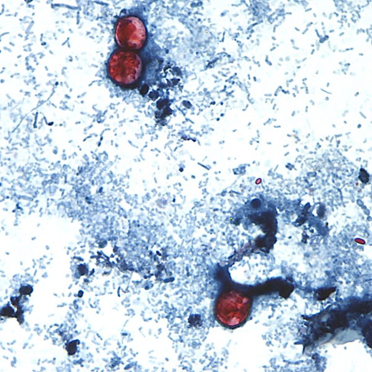 Multistate outbreak of foodborne parasitic illness reaches Virginia and Maryland Multistate outbreak of foodborne parasitic illness reaches Virginia and Maryland