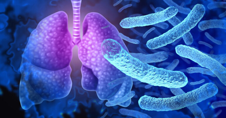What you need to know about Legionella/Legionnaire’s Disease What you need to know about Legionella/Legionnaire’s Disease