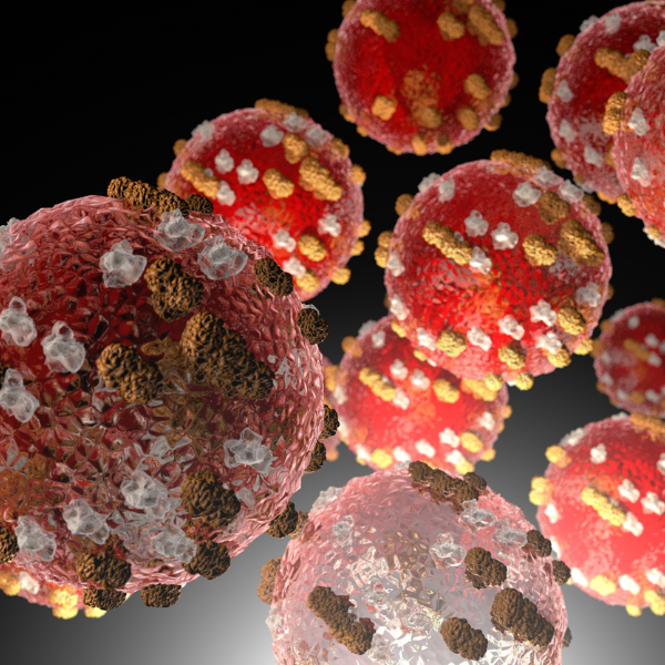 New Cluster of Measles Cases Identified, Plus Multiple Public Exposures New Cluster of Measles Cases Identified, Plus Multiple Public Exposures