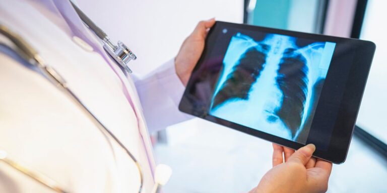 MSU researchers find new clues in rare pediatric lung disease