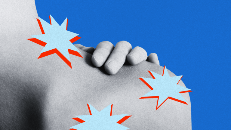 The Surprising Perimenopause Condition That Can Freeze Your Shoulder The Surprising Perimenopause Condition That Can Freeze Your Shoulder