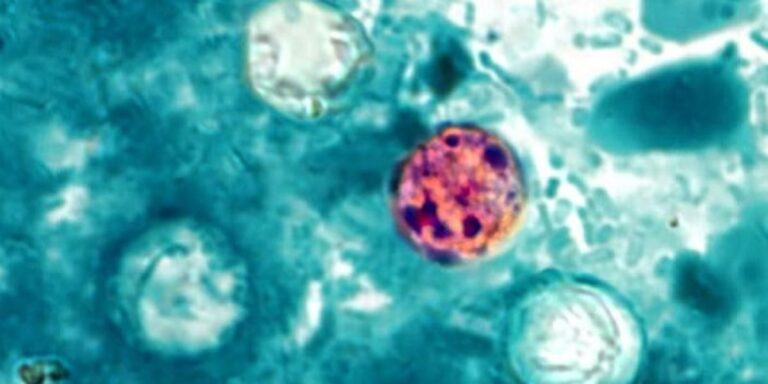 Health Department offers update on cyclosporiasis cases Health Department offers update on cyclosporiasis cases