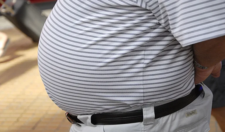 Obesity keeps more than 600,000 Britons out of work