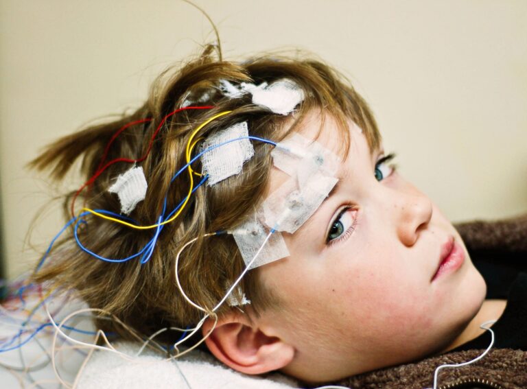 Bespoke ASOs Cut Seizures, Boost Skills in Rare Epilepsy Syndrome Bespoke ASOs Cut Seizures, Boost Skills in Rare Epilepsy Syndrome