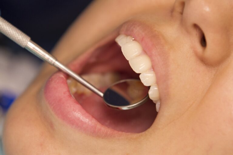 Treating Gum Disease Could Prevent Most Common Heart Valve Disease