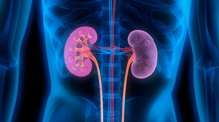 Type 1 Diabetes-Induced Kidney Disease Treated with Phase III Trial Drug