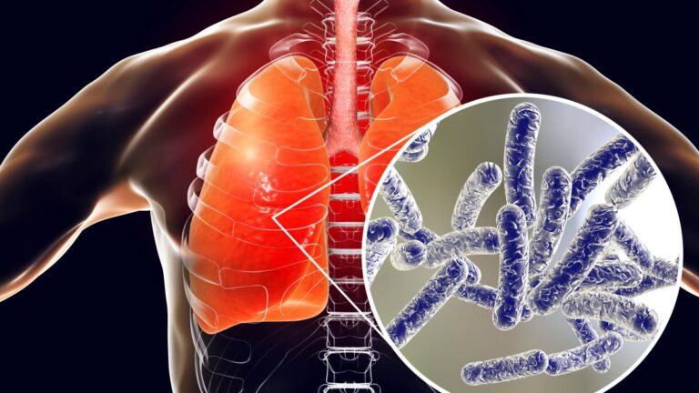 Legionnaires’ disease outbreak on Upper East Side expands again: What to know Legionnaires' disease outbreak on Upper East Side expands again: What to know