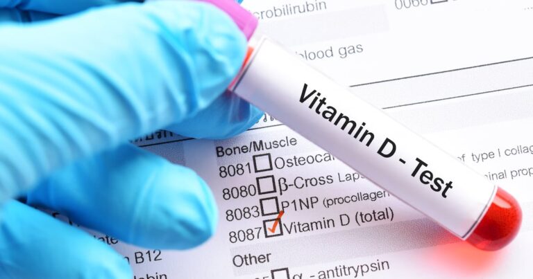 Scientists and nutrition experts call for increased vitamin D threshold to “wake up officials” Scientists and nutrition experts call for increased vitamin D threshold to “wake up officials”
