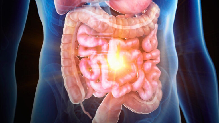 Scientists Create a ‘Gut-on-a-Chip’ That Reveals Hidden Drivers of Inflammatory Bowel Disease Scientists Create a 'Gut-on-a-Chip' That Reveals Hidden Drivers of Inflammatory Bowel Disease