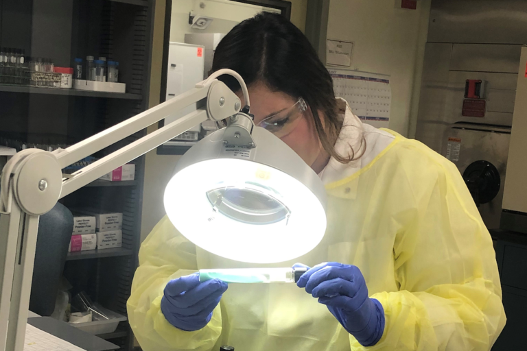 Tuberculosis on the rise in US: Local story angles to consider