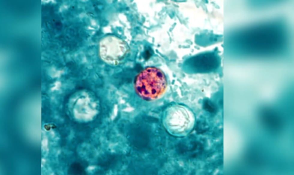 The parasite cyclospora which causes Cyclosporiasis