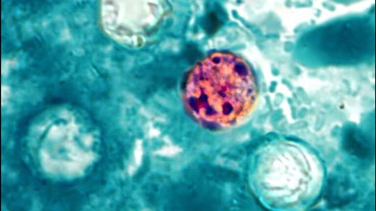 Healthcare providers offer advice on Cyclosporiasis entering Arkansas