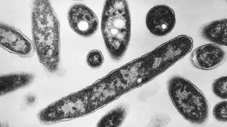 New York City Legionnaires’ disease outbreak linked to 7 deaths is declared over