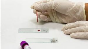 New Blood Marker Potentially Predicts the Emergence of Alzheimer's Symptoms