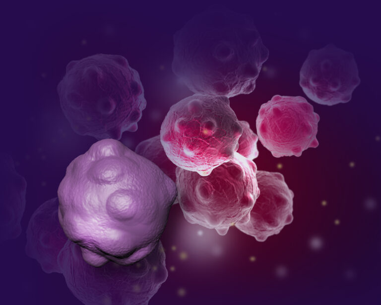 Study Uncovers How Obesity Influences Molecular Pathways in Breast Cancer Progression