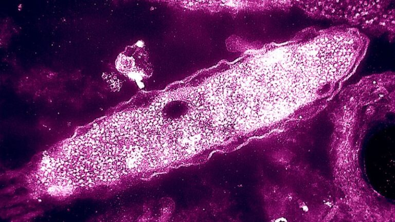 One death reported in New York City Legionnaires’ disease cluster