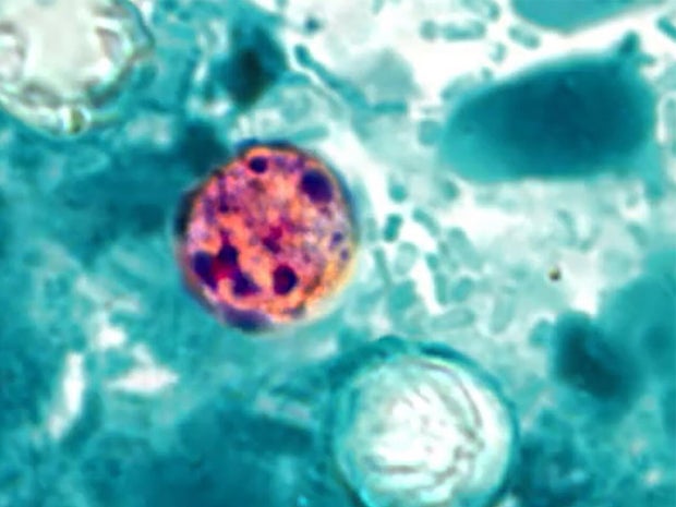 cyclospora-cyclosporiasis-1280.jpg