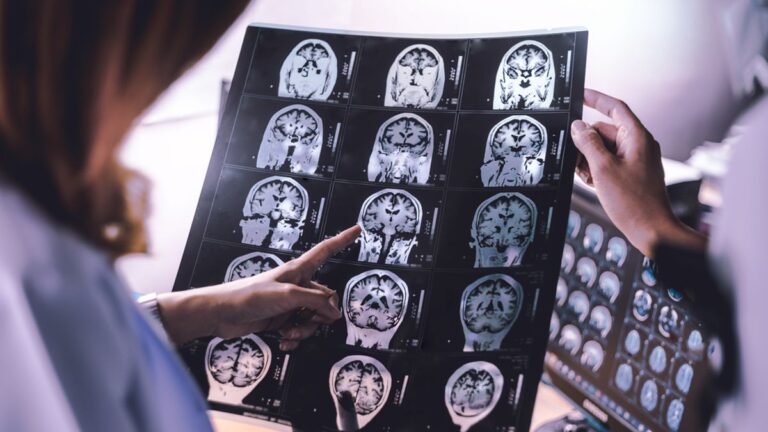 5 Recent Dementia Research Advances — From Blood Tests and Lithium to Lifestyle Changes