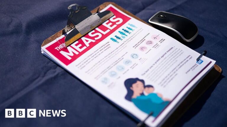US sees highest number of measles cases in 35 years